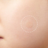 COSRX - Acne Pimple Master 24 Patches ~  لصقات حب الشباب من كوس آر أكس - 24 لصقة - Soko Store